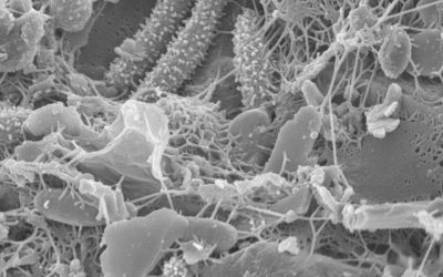 A Beginner’s Guide to Gut Bugs & Dysbiosis